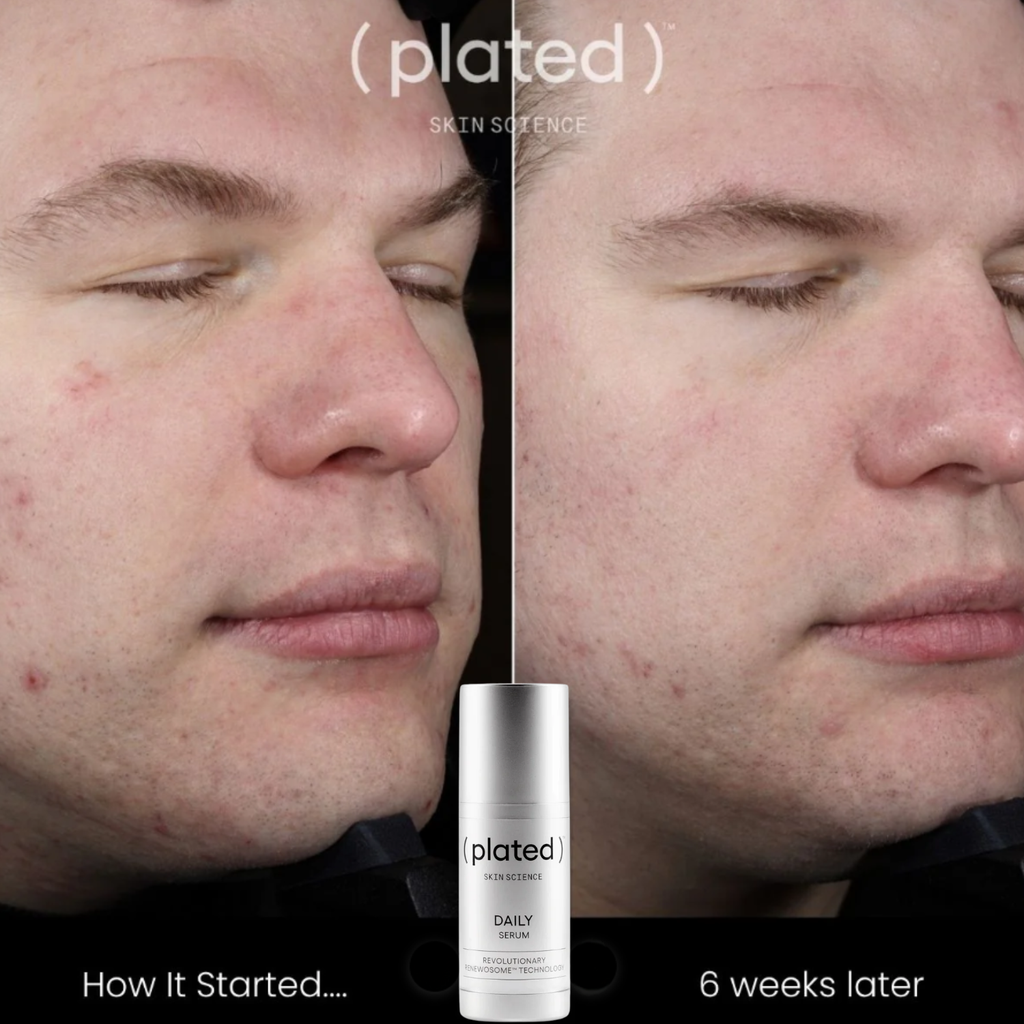 (plated) Daily Serum