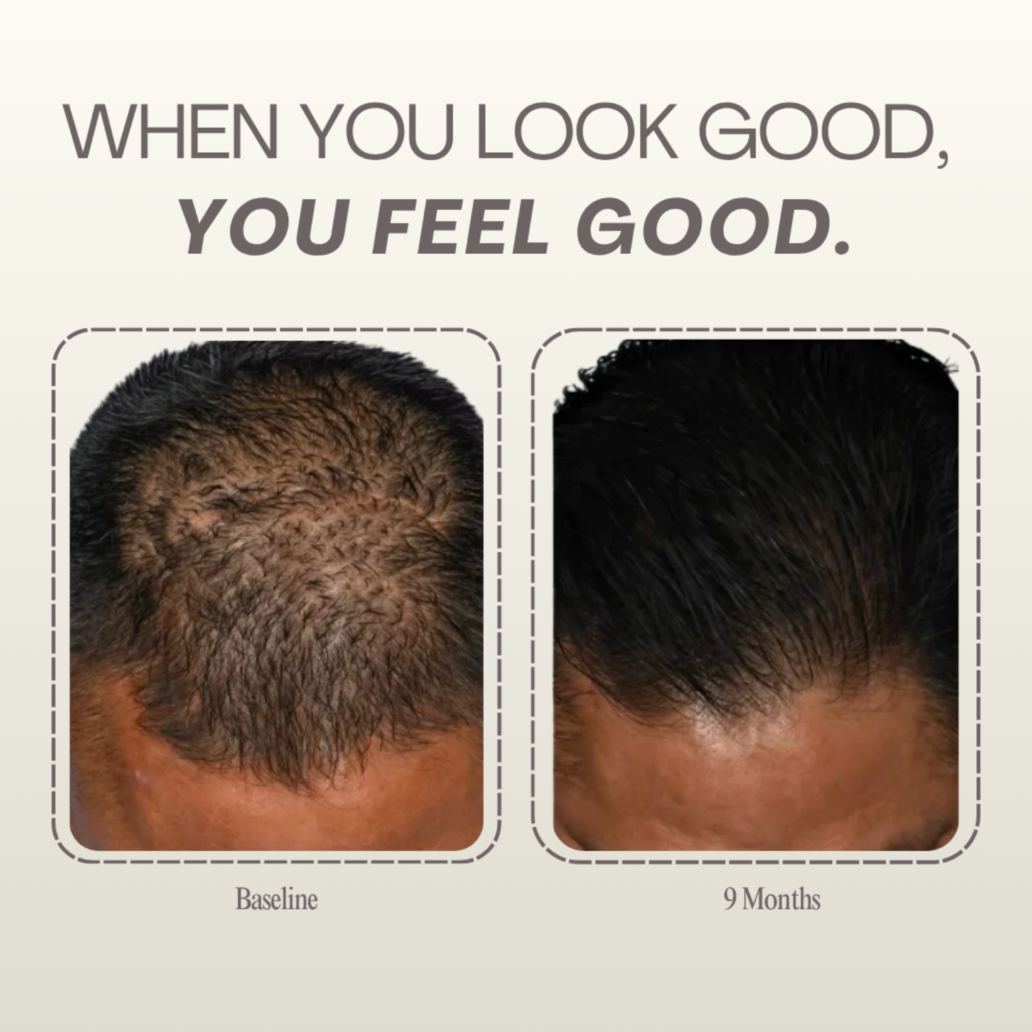 (plated) Hair Serum
