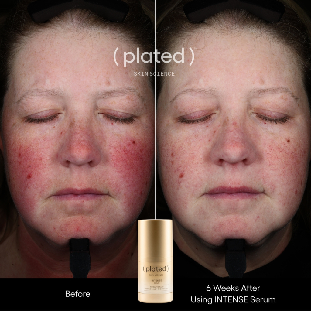 (plated) Intense Serum